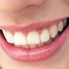 Healthy teeth and gums